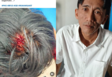 RSUD Lombok Timur Benahi Komunikasi Layanan, Kasus Kecelakaan ASN Jadi Evaluasi