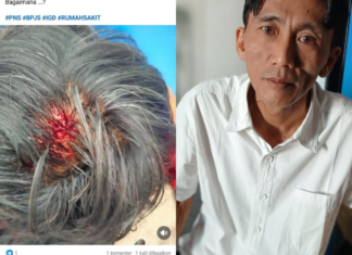 RSUD Lombok Timur Benahi Komunikasi Layanan, Kasus Kecelakaan ASN Jadi Evaluasi